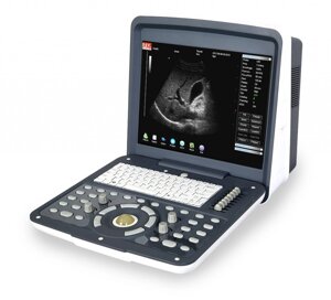 Аппарат цифровой ультразвуковой диагностический «AcuVista» RS880d 15 с батареей