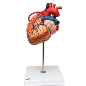 Модель сердца с шунтом, натуральная величина