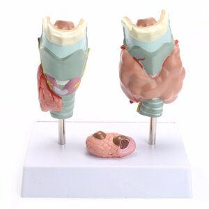 Модель заболеваний щитовидной железы, 4 части