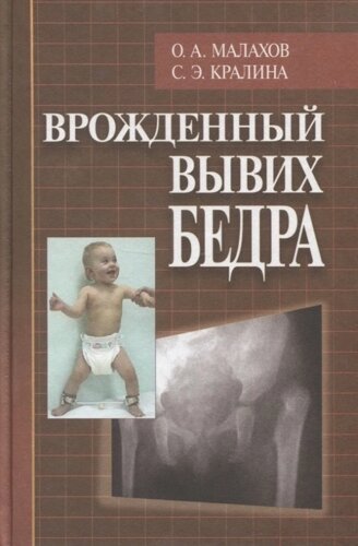 Врожденный вывих бедра (клиническая картина, диагностика, консервативное лечение)