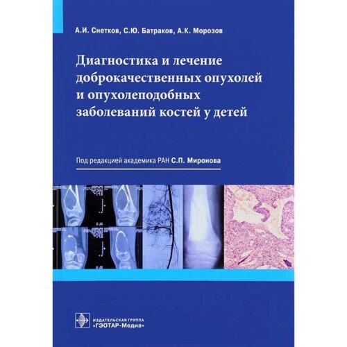 Морозов, Снетков, Батраков: Диагностика и лечение доброкачественных опухолей и опухолеподобных заболеваний костей у детей