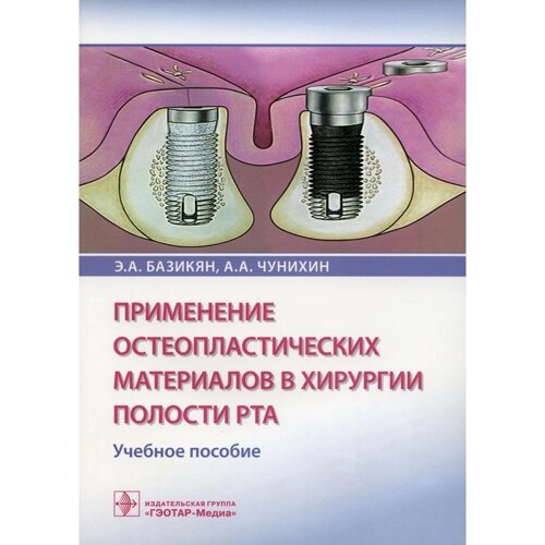 Применение остеопластических материалов в хирургии полости рта. Базикян Э. А., Чунихин А. А