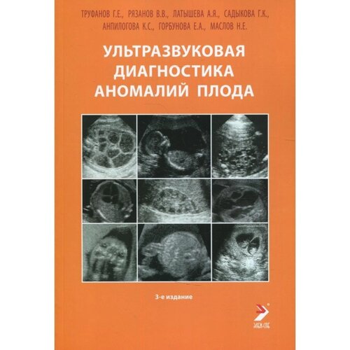 Ультразвуковая диагностика аномалий плода. 3-е издание. Труфанов Г. Е., Рязанов В. В., Латышева А. Я.