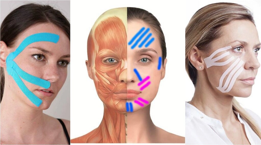 How To Use Kinesiology Tape For Face Wrinkles