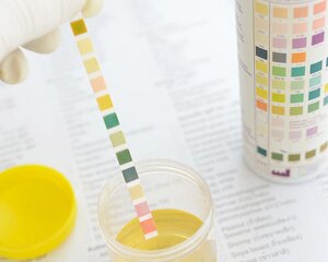 Тест-полоски индикаторные для определения глюкозы, кетоновых тел, белка и рН в моче Уриполиан-4А №50