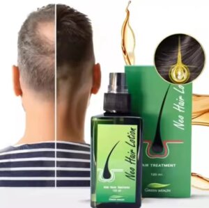 Лосьон для роста волос от облысения и выпадения Neo Hair Lotion 120 мл. Таиланд