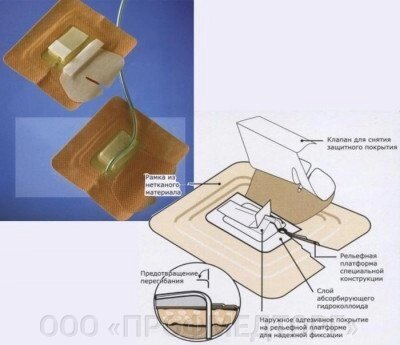 Стерильная защитная фиксирующая повязка для дренажей Drain-Fix от компании ООО «ПРОФМЕДТОРГ» - фото 1