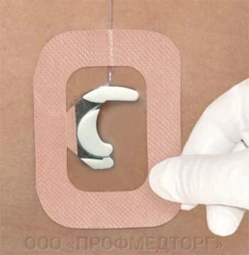 Стерильная защитная фиксирующая повязка для эпидуральных катетеров с прозрачной мембраной Epi-Fix от компании ООО «ПРОФМЕДТОРГ» - фото 1