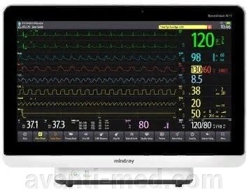 Монитор пациента Mindray BeneVision N19 от компании АВАНТИ Медицинская мебель и оборудование - фото 1