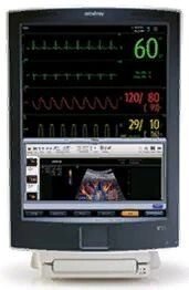 Монитор пациента Mindray V21 от компании АВАНТИ Медицинская мебель и оборудование - фото 1