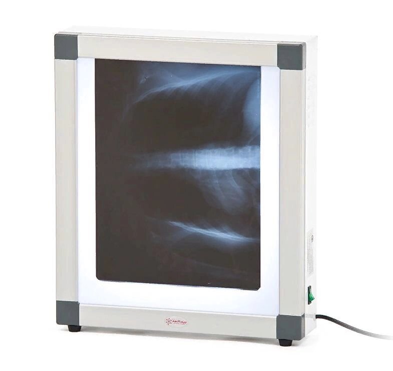Негатоскоп флуоресцентный Армед 1-кадровый от компании АВАНТИ Медицинская мебель и оборудование - фото 1