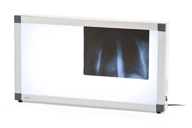 Негатоскоп флуоресцентный Армед 2-кадровый от компании АВАНТИ Медицинская мебель и оборудование - фото 1