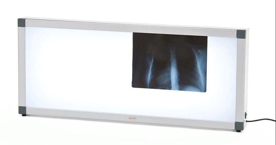 Негатоскоп флуоресцентный Армед 3-кадровый от компании АВАНТИ Медицинская мебель и оборудование - фото 1
