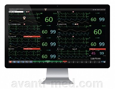 Станция центрального мониторирования Storm Dixion от компании АВАНТИ Медицинская мебель и оборудование - фото 1