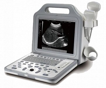 Ультразвуковой портативный цифровой сканер Opus-5000 от компании АВАНТИ Медицинская мебель и оборудование - фото 1