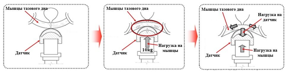 Принцип работы датчика для тренировки мышц тазового дна