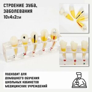 Макет "Строение зуба, заболевания", 10*4*2см в Москве от компании М.Видео
