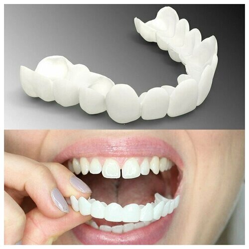 Накладные виниры для зубов Snap-On Smile 1 шт, на верхнюю челюсть