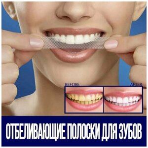 Отбеливающие полоски для зубов, 7 пар
