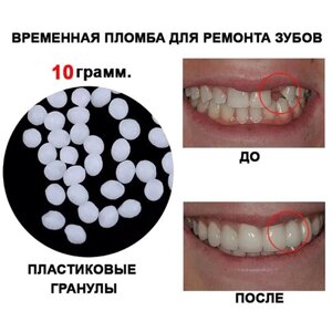 Временная пломба или зуб 10гр.