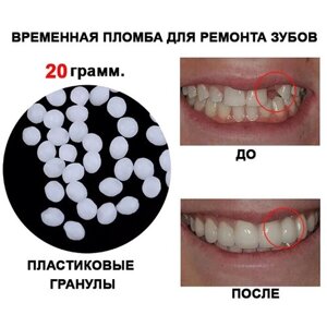 Временная пломба или зуб 20гр.