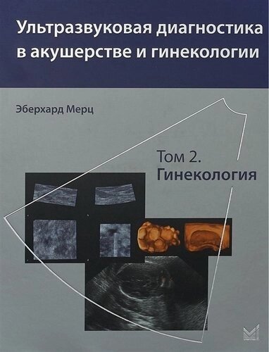 Ультразвуковая диагностика в акушерстве и гинекологии. Т. 2.