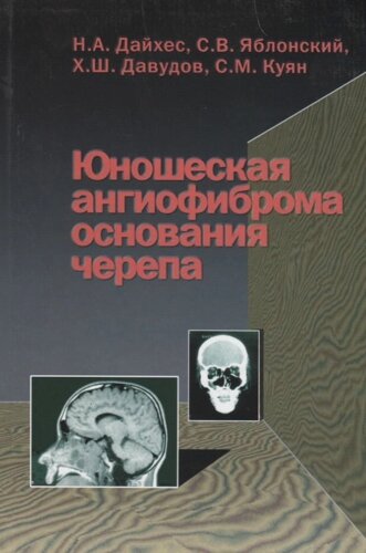 Юношеская ангиофиброма основания черепа