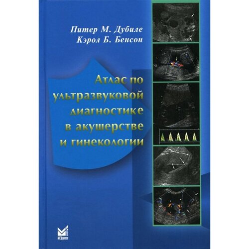Атлас по ультразвуковой диагностике в акушерстве и гинекологии. 4-е издание. Дубиле П., Бенсон К. Б.