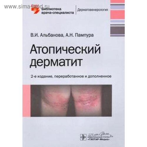 Атопический дерматит. 2-е издание. Альбанова В., Пампура А. Н.