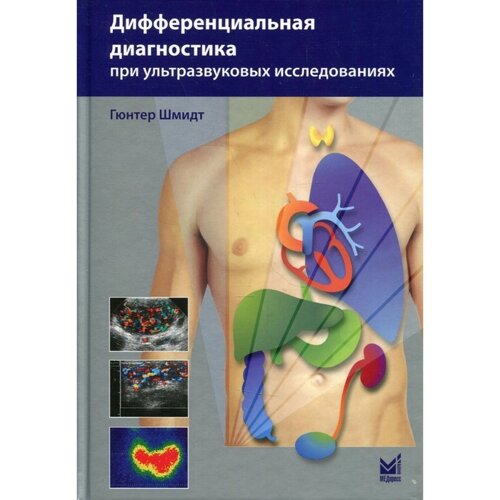 Дифференциальная диагностика при ультразвуковых исследованиях. 2-е издание. Гюнтер Шмидт
