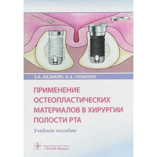 Применение остеопластических материалов в хирургии полости рта