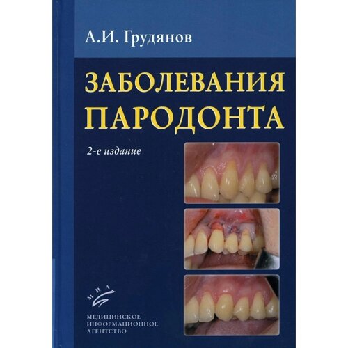 Заболевания пародонта. 2-е издание, дополненное и переработанное. Грудянов А. И.