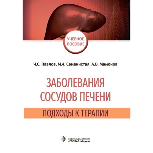 Заболевания сосудов печени. Павлов Ч. и другие