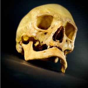 Анатомический женский череп человека "Старуха"