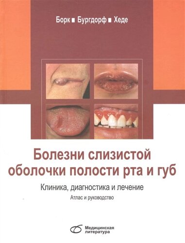 Болезни слизистой оболочки полости рта и губ. Клиника, диагностика и лечение. Атлас и руководство