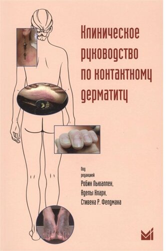 Клиническое руководство по контактному дерматиту. Диагностика и лечение в зависимости от области поражения