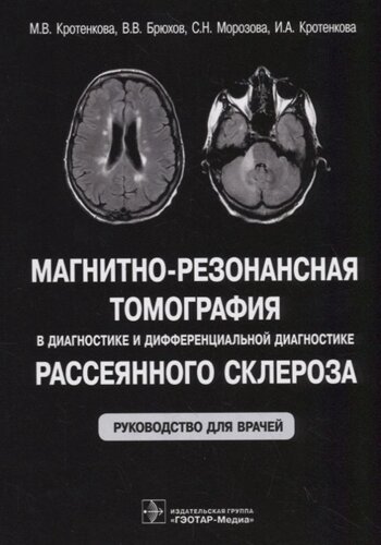 Магнитно-резонансная томография в диагностике и дифференциальной диагностике рассеянного склероза. Руководство для врачей