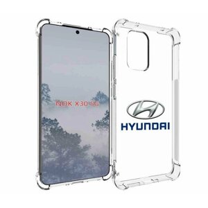 Чехол MyPads hyundai-4 мужской для Nokia X30 5G задняя-панель-накладка-бампер