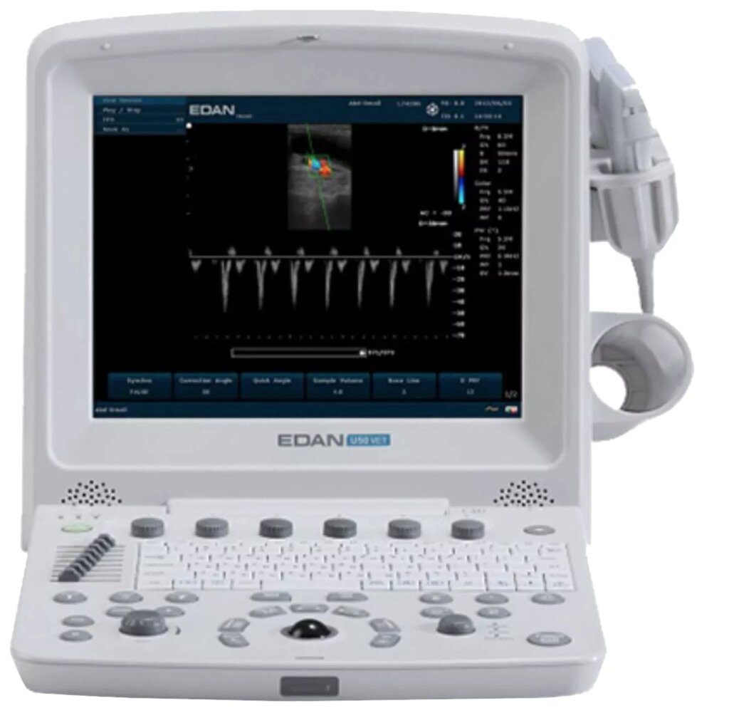 Портативный аппарат УЗИ Edan U50 (для кардиологии, стандартный) от компании МскМедпром - фото 1
