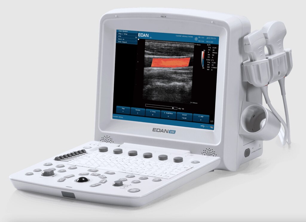 Портативный аппарат УЗИ Edan U50 (для педиатрии и кардиологии, стандартный) от компании МскМедпром - фото 1